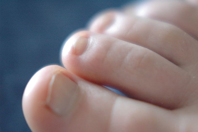 640px-Toes